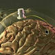 Illustration for article titled Ultrathin, Rubbery Circuits Bring Us One Step Closer to Google Brain Implants